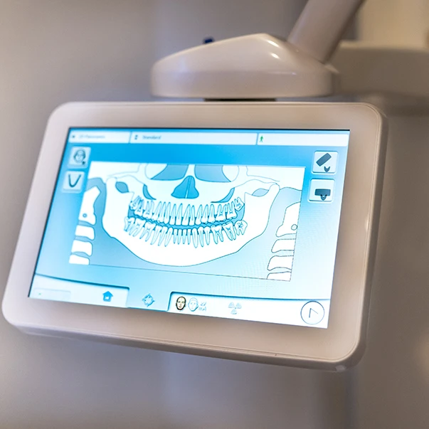 A digital X-ray of a full set of teeth on the chairside screen